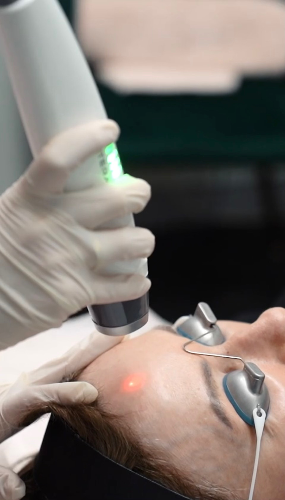 Cutera Genesis Laser — Sanctuary Cosmetic Clinics