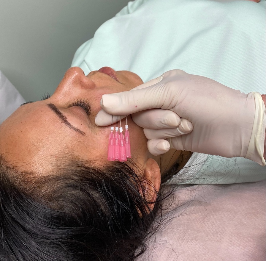 Threads &mdash; Sanctuary Cosmetic Clinics